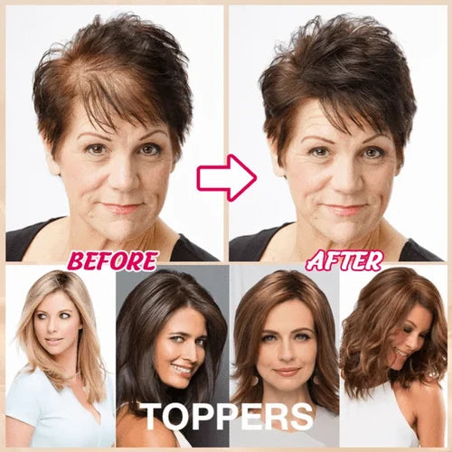 🔥Breathable and natural hair toppers for women with thinning hair